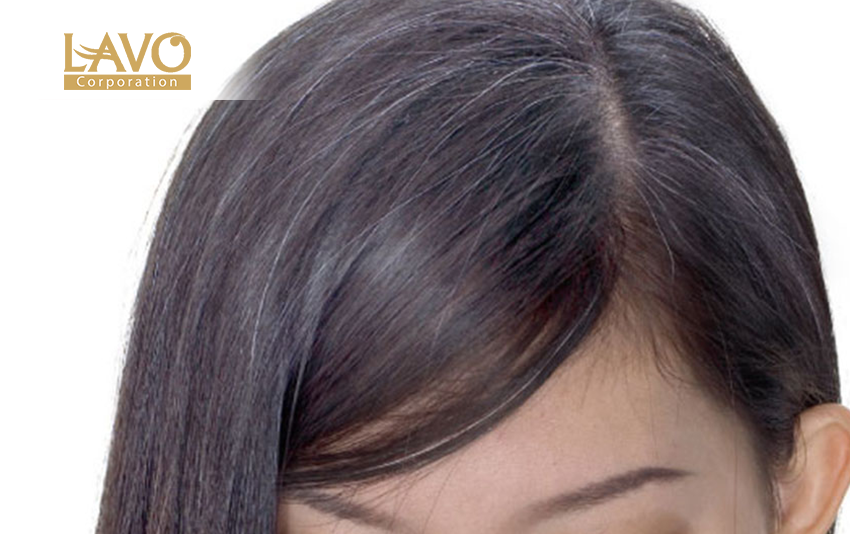 Nguyên Nhân Tóc Bạc Sớm