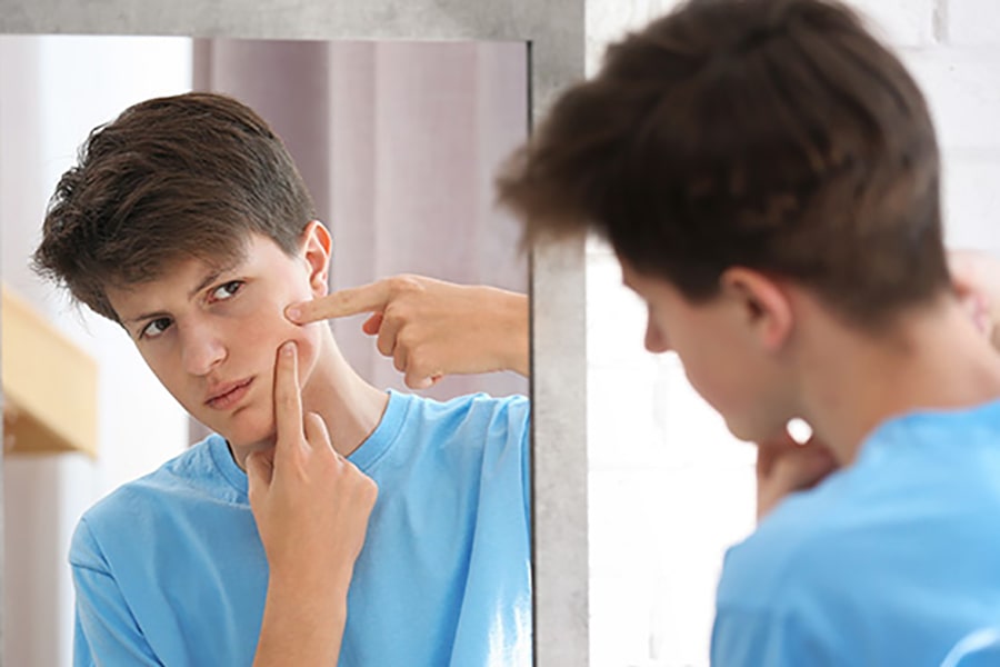 Sữa rửa mặt cho nam tuổi dậy thì nào tốt nhất hiện nay?